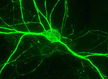 Scoperta la proteina Apache, guida del sistema nervoso